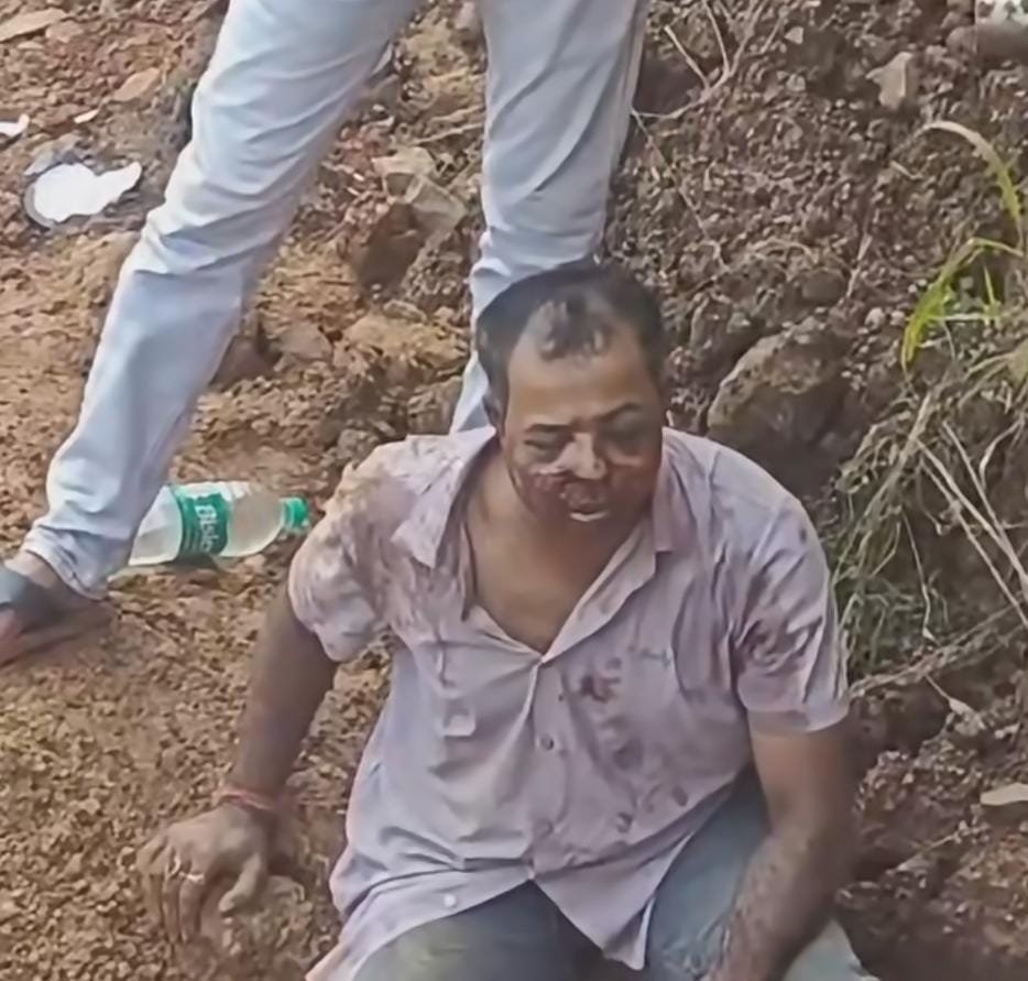 जर्जर सड़क के गड्ढे में गिरे युवक की पूरी रात तड़पते बीती, सुबह मोबाइल लोकेशन से बची जान 2 IMG 20260919 WA0033